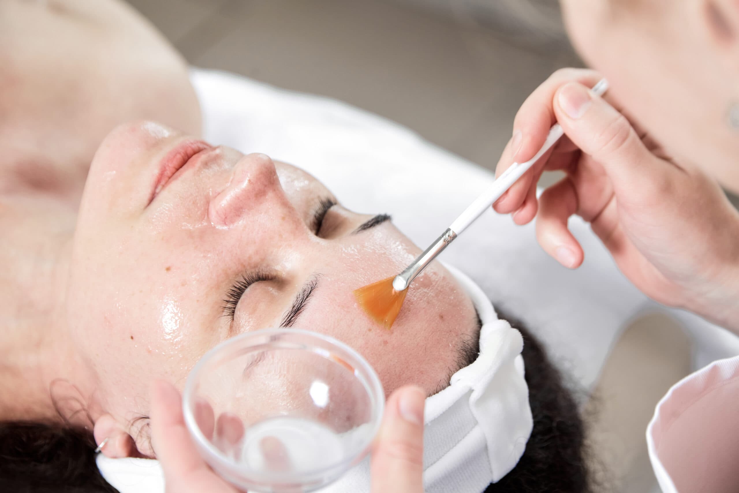 Lady having peel treatment